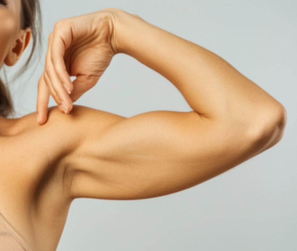 underarm and arm laser hair removal, Melbourne laser hair removal for arms and armpits women