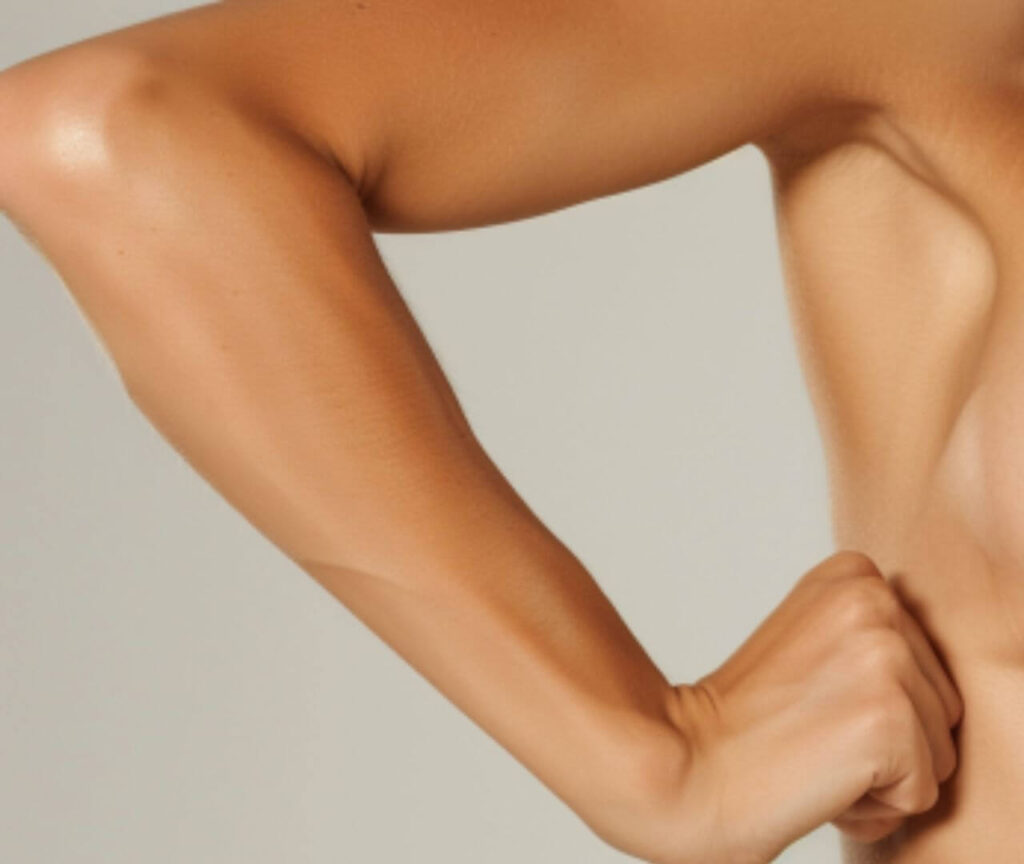 upper body laser hair removal, arm laser hair removal, full arm laser hair removal, full arms laser for women in Melbourne