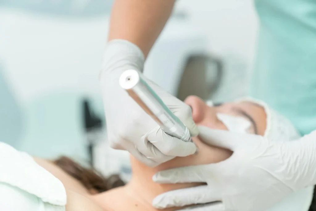 How Safe and Effective is Laser Hair Removal in Melbourne?