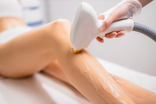 Is Laser Hair Removal Safe for All Skin Tones?